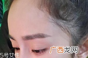 发际线高怎么治？拯救发际线攻略