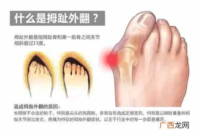 腿粗短穿什么单鞋好看吗（夏季小个子女生穿什