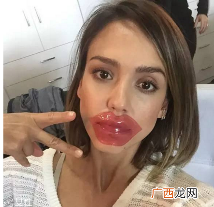 怎么使用唇膜更好发挥作用?敷完唇膜后需要护理