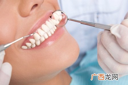 牙齿清洁不当没回诊当心植牙全掉光