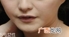 颈纹是怎么产生的？比面部肌肤更加脆弱
