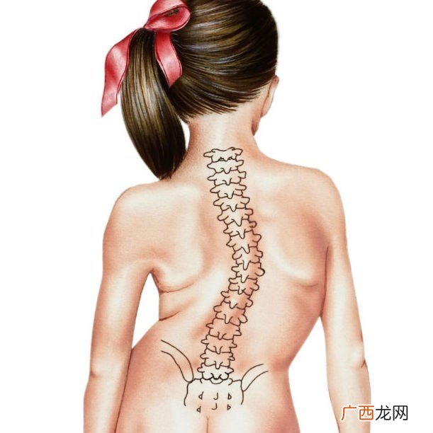 脊椎侧弯自我检测的方法什么是脊椎侧弯