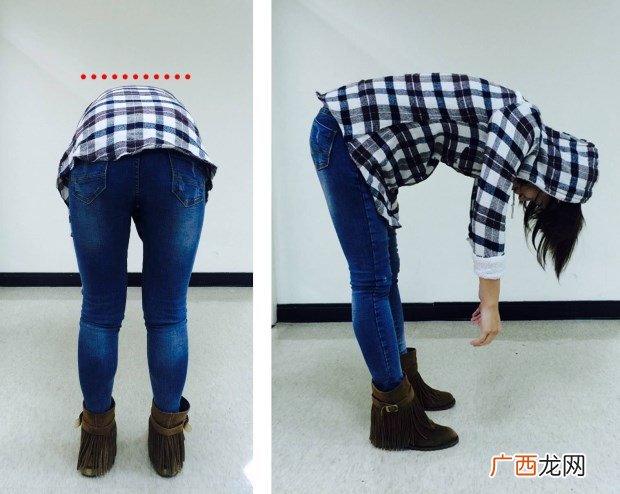 脊椎侧弯自我检测的方法什么是脊椎侧弯
