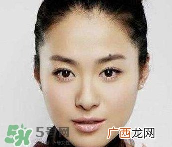如何预防脸上长痣？怎样预防脸上长痣