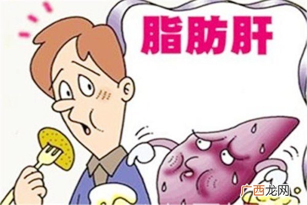 减脂肪肝可以做什么运动脂肪肝怎么检查