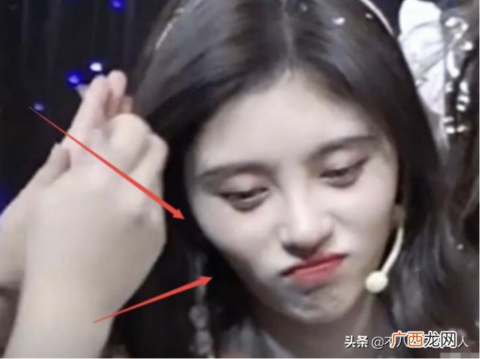 鞠婧祎为什么老是用手挡着脸，鞠婧祎万年刘海挡右脸