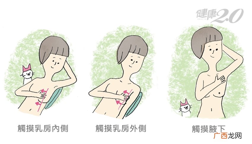 怎样判断乳房健康每月3步骤自我检查