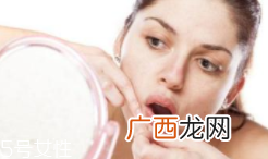 肌肤需要排毒吗？长痘并不代表排毒