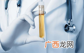 小便很黄而且有泡泡是怎么回事