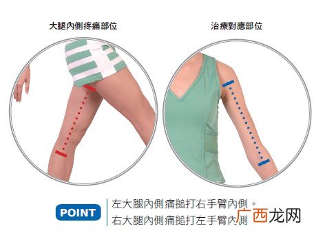 最近感觉大腿酸痛是怎么回事