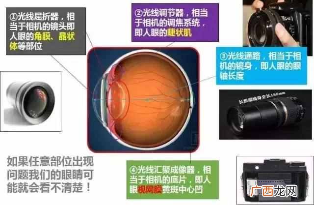 近视眼可以分为哪几类 什么是指数近视