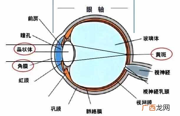 近视眼可以分为哪几类 什么是指数近视