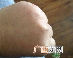 康恩贝维生素b族片怎么样,效果好吗?