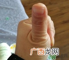 康恩贝维生素b族片怎么样,效果好吗?