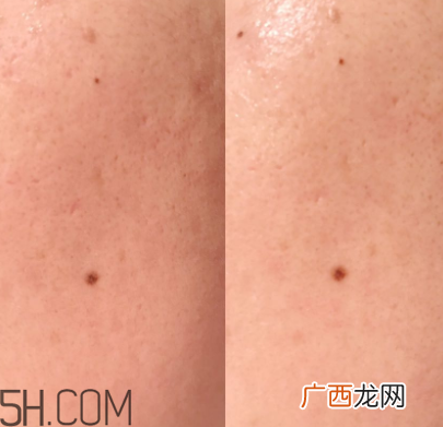兰蔻美肤修护美容液可以代替乳液吗？什么功效？