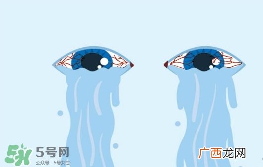 眼药水可以两个人用吗？眼药水可以共用吗？