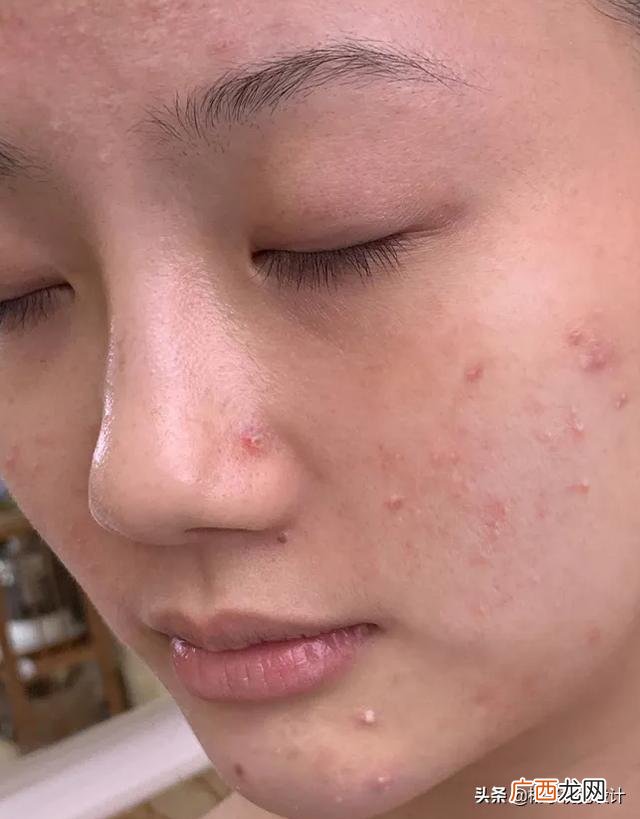 长期用马油皂好不好,经常用马油皂洗脸好不好