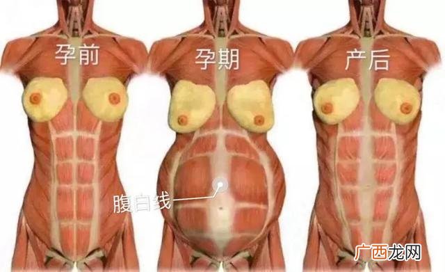产后腹直肌最佳恢复期,月满馨国际产后恢复中心地址