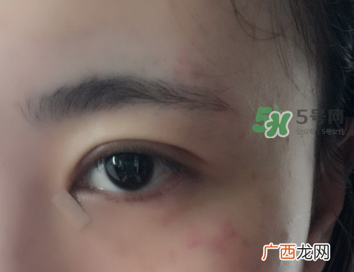美皮护在哪里买是正品？美皮护正品哪里有卖？