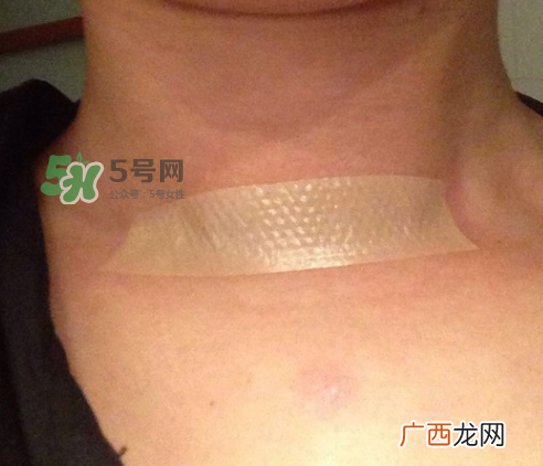 美皮护怎么使用？美皮护使用方法