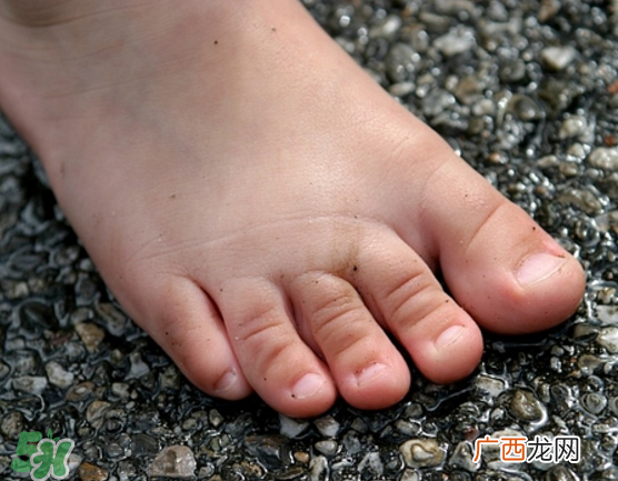 日本灰指甲药水有用吗？日本灰指甲药水评测