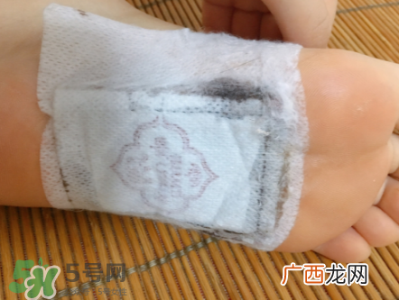 兰纳足贴多少钱?兰纳足贴价格