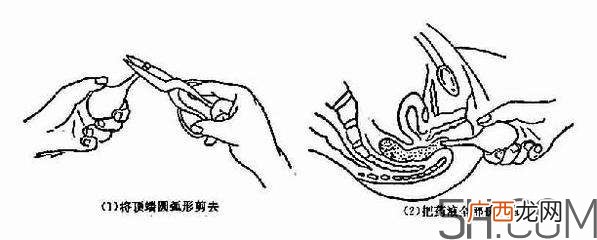 开塞露怎么用？开塞露用后多久会排便？