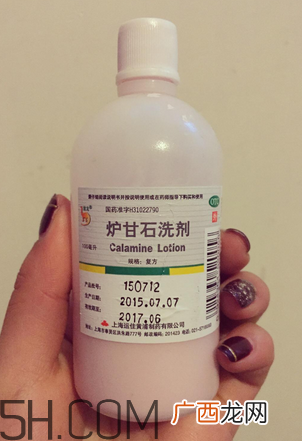 炉甘石洗剂多少钱一瓶?炉甘石洗剂治痤疮吗?