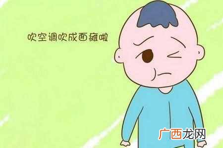 面瘫什么症状 什么叫面瘫