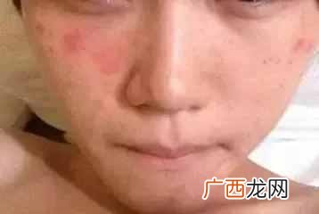 什么乳液美白效果好（口碑最好的美白护肤品推