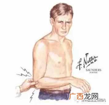 打封闭针是好是坏 什么是打封闭