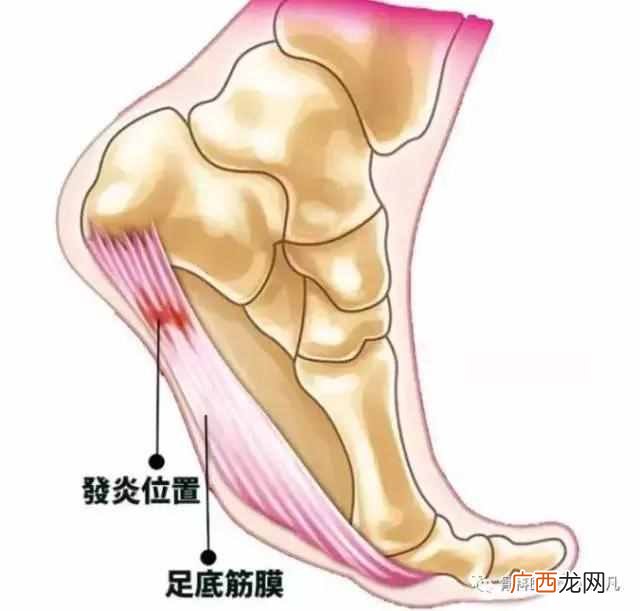 打封闭针是好是坏 什么是打封闭