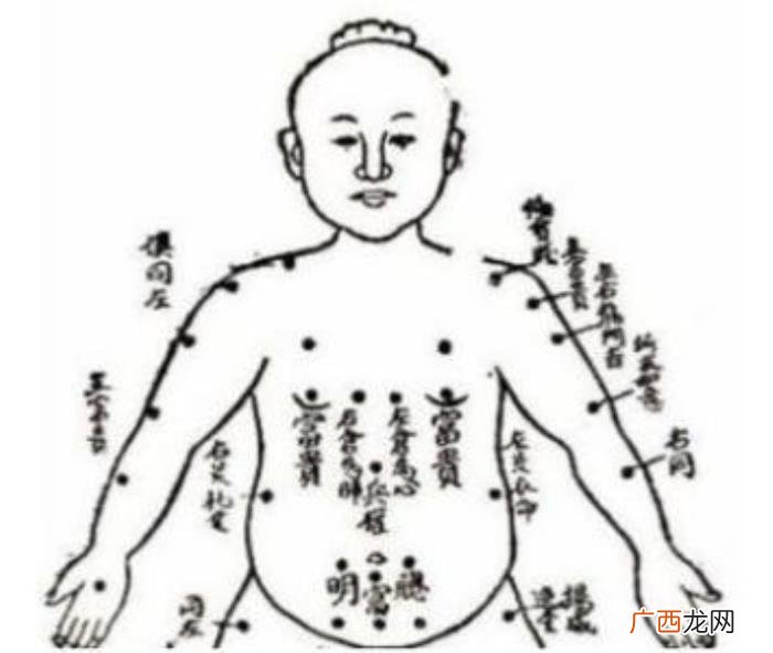 屁股有痣的女人，细数女人身上的幸福好运痣