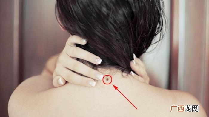 屁股有痣的女人，细数女人身上的幸福好运痣