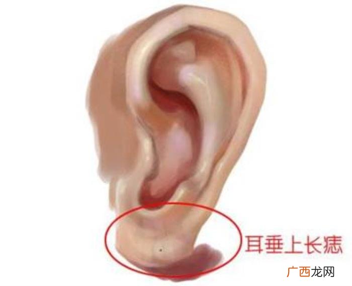屁股有痣的女人，细数女人身上的幸福好运痣