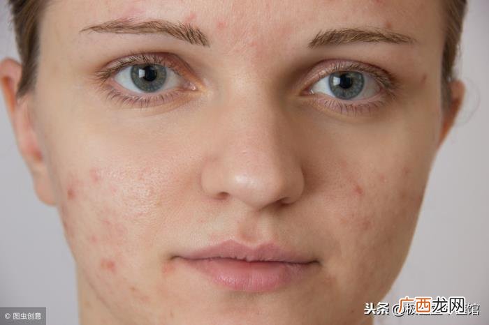 哪些特征看出女人不孕不育 不能生育的女人特征