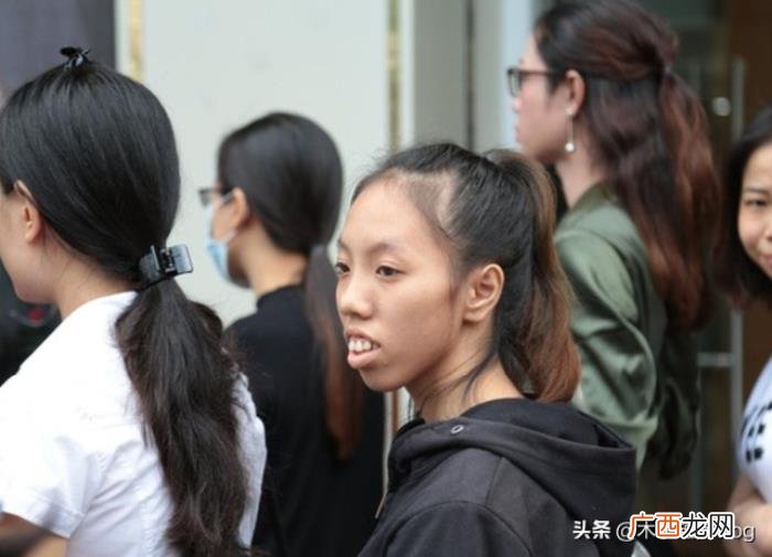 越南女子因长相而活在阴影中 越南人长相