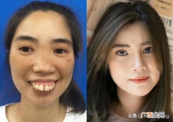 越南女子因长相而活在阴影中 越南人长相