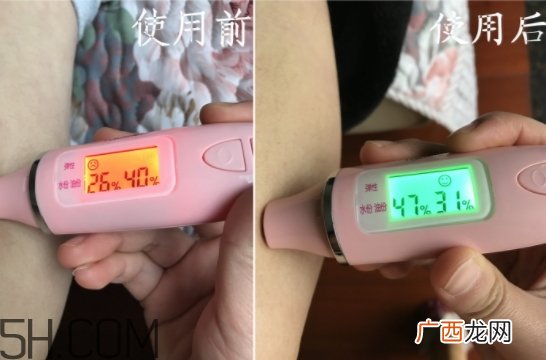 水杨酸可以去黑头吗？水杨酸可以去闭口吗