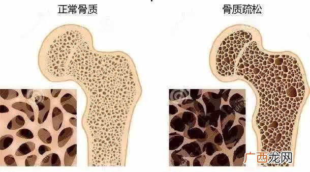 中老年怎么补钙效果最好的方法，老年补钙吃哪