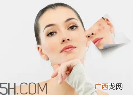 医院刷酸用的是什么？为什么医院刷酸那么贵