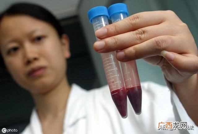 费用大概是多少 亲子鉴定需要什么手续