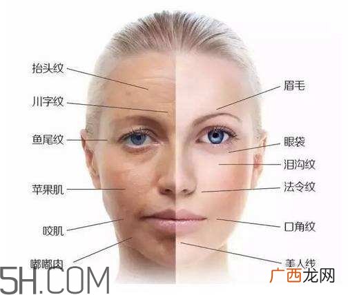 怎么预防皱纹的产生？导致皱纹的产生的原因有哪些？