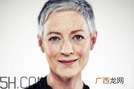怎么预防皱纹的产生？导致皱纹的产生的原因有哪些？