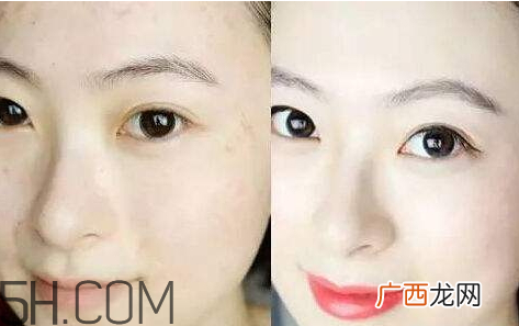 贝洛娜水光针骗局 贝洛娜水光针真假辨别