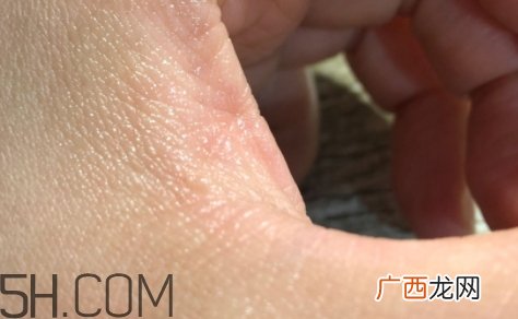 雅顿金胶适合什么肤质？雅顿金胶适合油皮和混油皮吗？