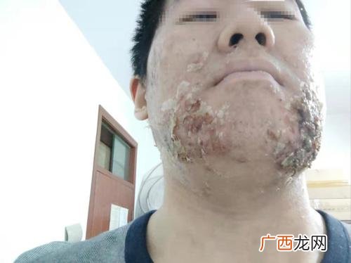 山羊养殖技术视频观看 牛黄养殖技术视频
