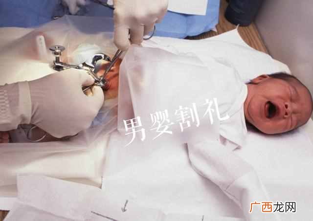解读男性割礼和女性割礼的区别 割礼是什么
