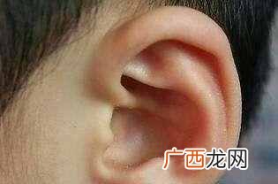 “反骨耳”是什么样子 什么是反骨
