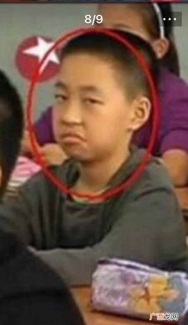 “反骨耳”是什么样子 什么是反骨
